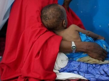 Deadly delays: How funding gaps are undermining health care in Somalia