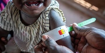 Two-thirds of global hunger concentrated in 10 conflict-hit countries